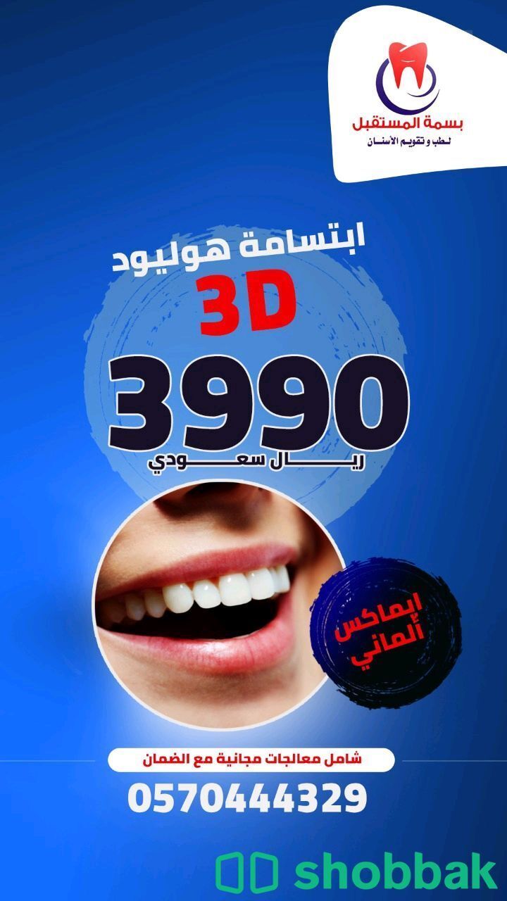 ابتسامة هوليوود بتصوير ثلاثي الأبعاد 3d الالمانيه  Shobbak Saudi Arabia
